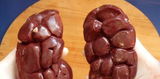 Czy nerka liczy się jako bagaż podręczny Wizz Air?