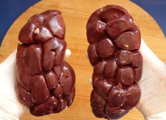 Czy nerka liczy się jako bagaż podręczny Wizz Air?